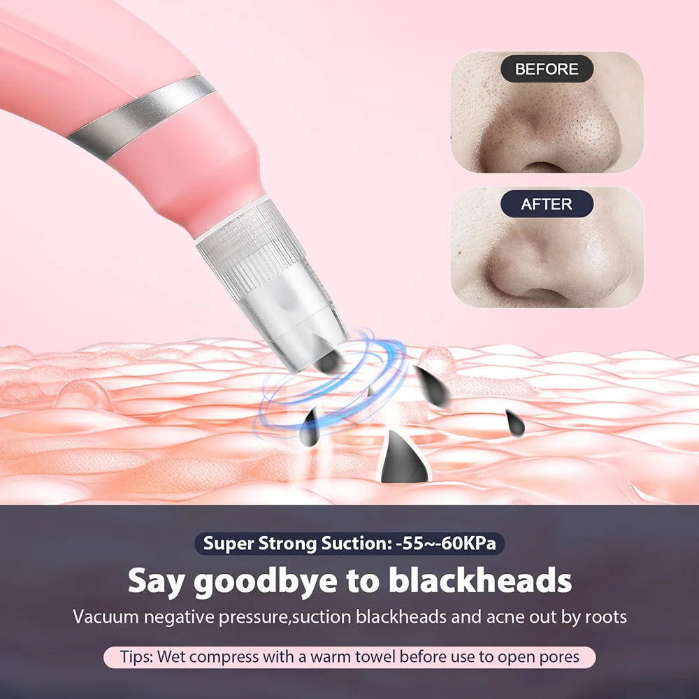 2-in-1 Handheld Skin Polishing Exfoliation Machine Anti-Aging Facial Beauty Deep Cleaning Skin Care
