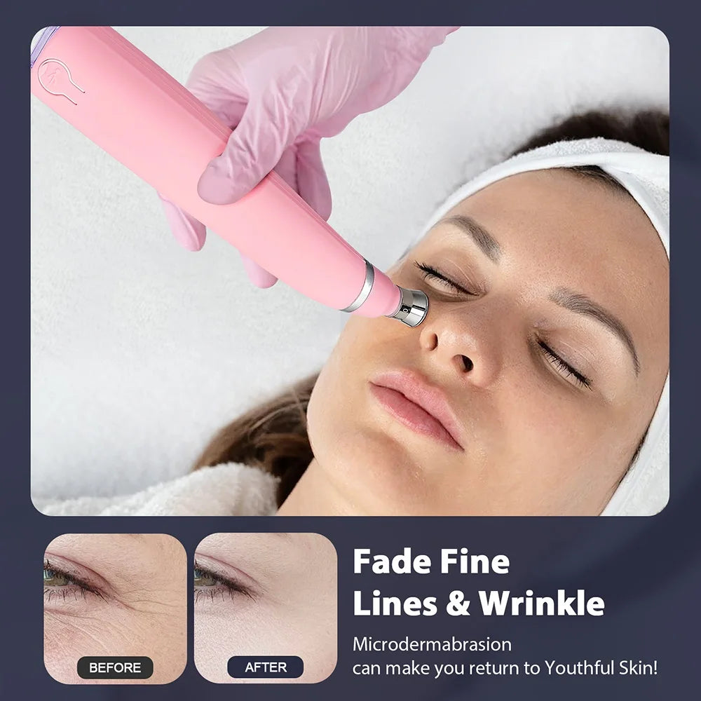 2-in-1 Handheld Skin Polishing Exfoliation Machine Anti-Aging Facial Beauty Deep Cleaning Skin Care