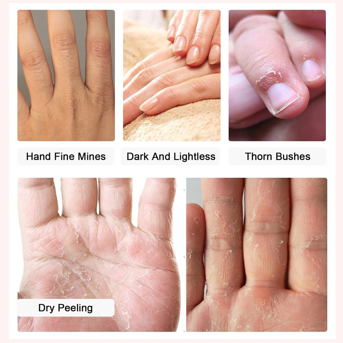 Amococo 15/25pairs Niacinamide Hand Masks Moisturizing Hand Gloves Softening Hydrating Hand Care Mask with Vitamin E Avocado Oil for Dry Hands Smooth Skin Spa Treatment